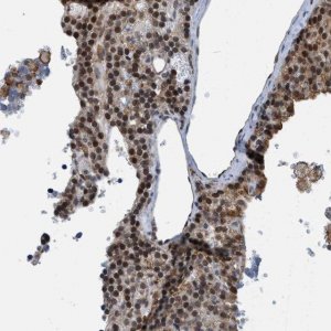 Anti-CBX5 antibody produced in rabbit 
