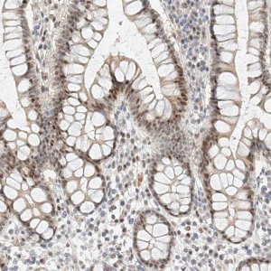 Anti-CBX8 antibody produced in rabbit HPA031462-100UL