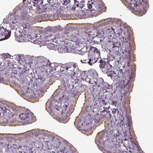 Anti-CCDC114 antibody produced in rabbit 