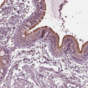 Anti-CCDC114 antibody produced in rabbit 