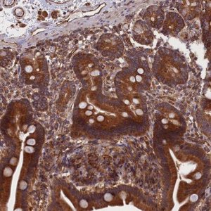 Anti-CCDC124 antibody produced in rabbit 