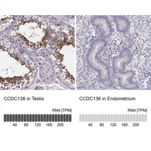 Anti-CCDC136 antibody produced in rabbit 