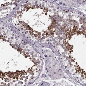Anti-CCDC136 antibody produced in rabbit 