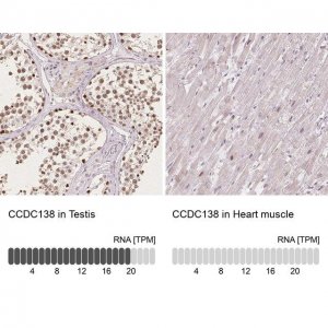Anti-CCDC138 antibody produced in rabbit 