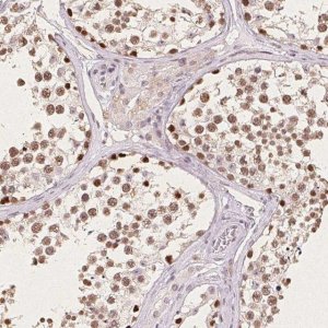 Anti-CCDC138 antibody produced in rabbit 