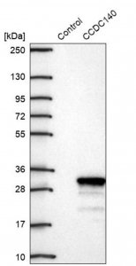 Anti-CCDC140 antibody produced in rabbit 