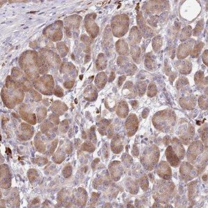 Anti-CCDC140 antibody produced in rabbit 
