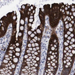 Anti-CCDC144NL antibody produced in rabbit 
