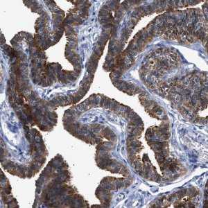 Anti-CCDC146 antibody produced in rabbit 