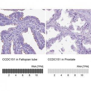Anti-CCDC151 antibody produced in rabbit 