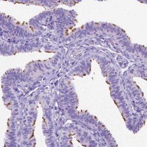 Anti-CCDC151 antibody produced in rabbit 