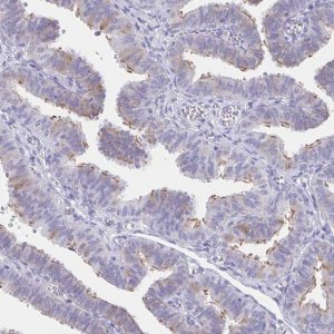 Anti-CCDC17 antibody produced in rabbit 