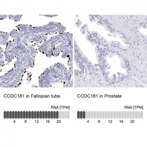 Anti-CCDC181 antibody produced in rabbit 
