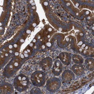 Anti-CCDC186 antibody produced in rabbit 