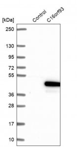 Anti-CCDC189 antibody produced in rabbit 