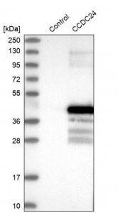 Anti-CCDC24 antibody produced in rabbit 