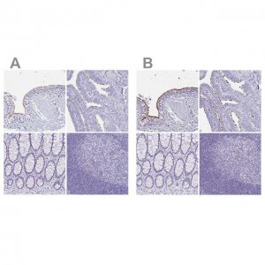 Anti-CCDC39 antibody produced in rabbit 