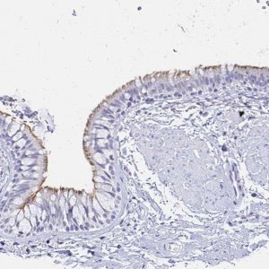 Anti-CCDC39 antibody produced in rabbit 