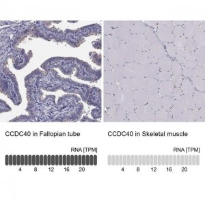 Anti-CCDC40 antibody produced in rabbit 