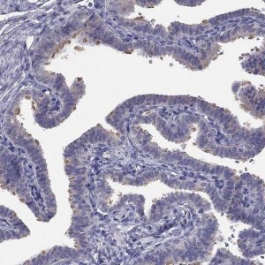 Anti-CCDC40 antibody produced in rabbit 
