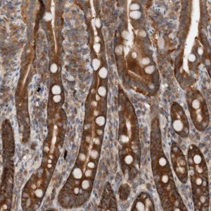 Anti-CCDC43 antibody produced in rabbit 