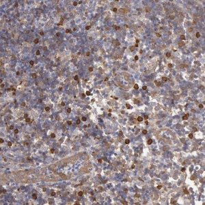 Anti-CCDC50 antibody produced in rabbit 