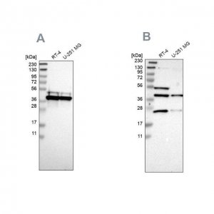Anti-CCDC51 antibody produced in rabbit 