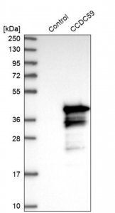 Anti-CCDC59 antibody produced in rabbit 
