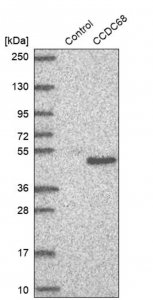Anti-CCDC68 antibody produced in rabbit 