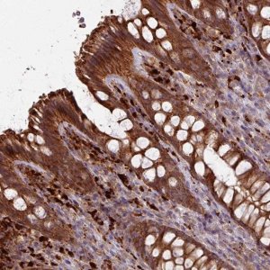 Anti-CCDC68 antibody produced in rabbit 