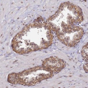 Anti-CCDC9 antibody produced in rabbit 