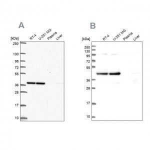 Anti-CCDC94 antibody produced in rabbit 
