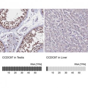 Anti-CCDC97 antibody produced in rabbit 