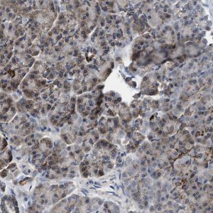 Anti-CCM2 antibody produced in rabbit 