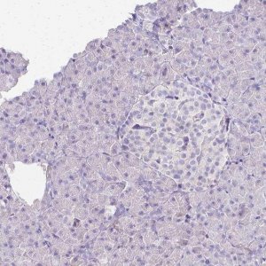 Anti-CCNB1 antibody produced in rabbit 