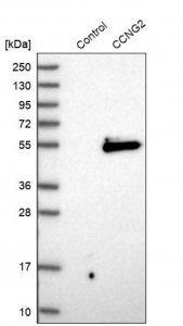 Anti-CCNG2 antibody produced in rabbit HPA034684-100UL