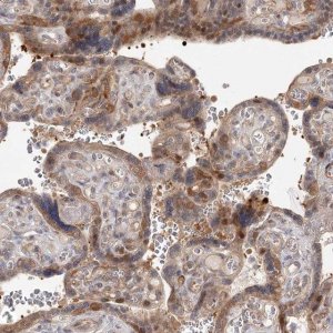 Anti-CCNG2 antibody produced in rabbit HPA034684-100UL