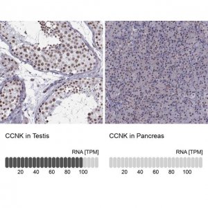 Anti-CCNK 