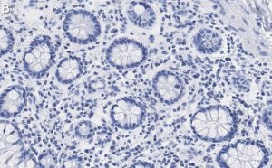 Anti-CCPG1 Antibody, clone 1F15 ZooMAb Rabbit Monoclonal 