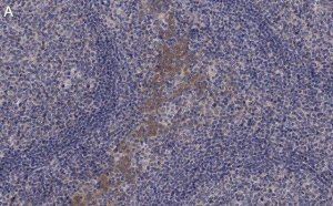 Anti-CCR2 Antibody, clone 5K5-3 ZooMAb Rabbit Monoclonal 