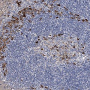 Anti-CCR4 antibody produced in rabbit 