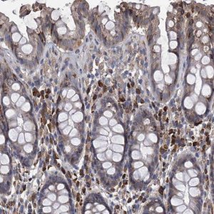 Anti-CCR4 antibody produced in rabbit 