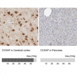 Anti-CCSAP antibody produced in rabbit 