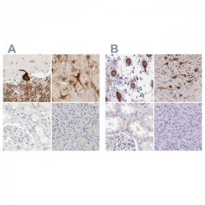 Anti-CCSAP antibody produced in rabbit 