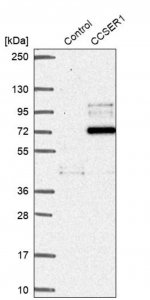 Anti-CCSER1 antibody produced in rabbit 
