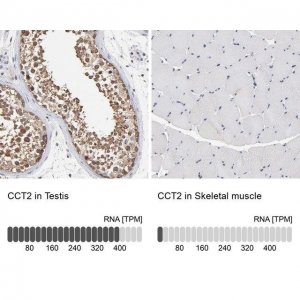 Anti-CCT2 antibody produced in rabbit 