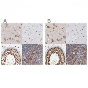 Anti-CCT2 antibody produced in rabbit 