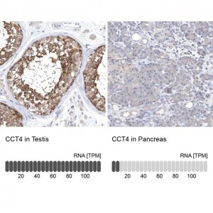 Anti-CCT4 antibody produced in rabbit HPA029349-100UL