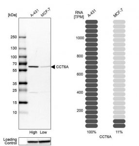 Anti-CCT6A antibody produced in rabbit HPA042996-100UL