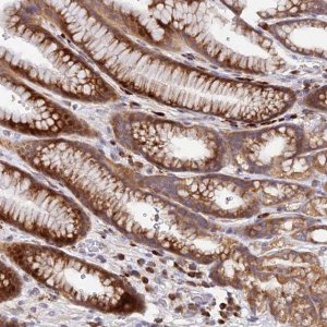 Anti-CCT6A antibody produced in rabbit HPA042996-100UL